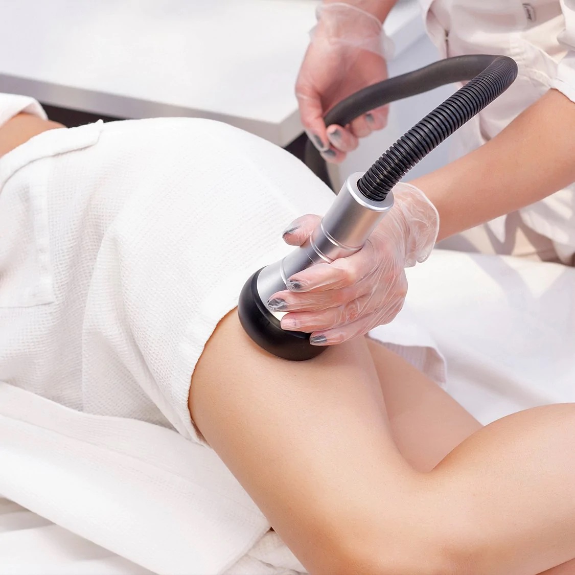 Vacumterapia: imagen del tratamiento